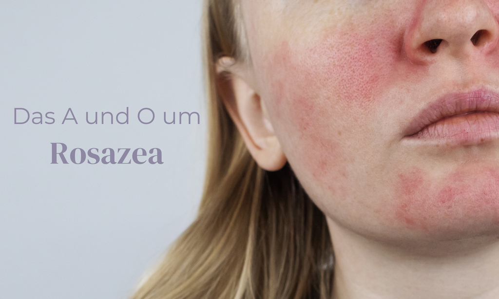 Das A O Der Rosazea Fakten Rosalique Deutschland das-a-o-der-rosazea-fakten-rosalique-deutschland