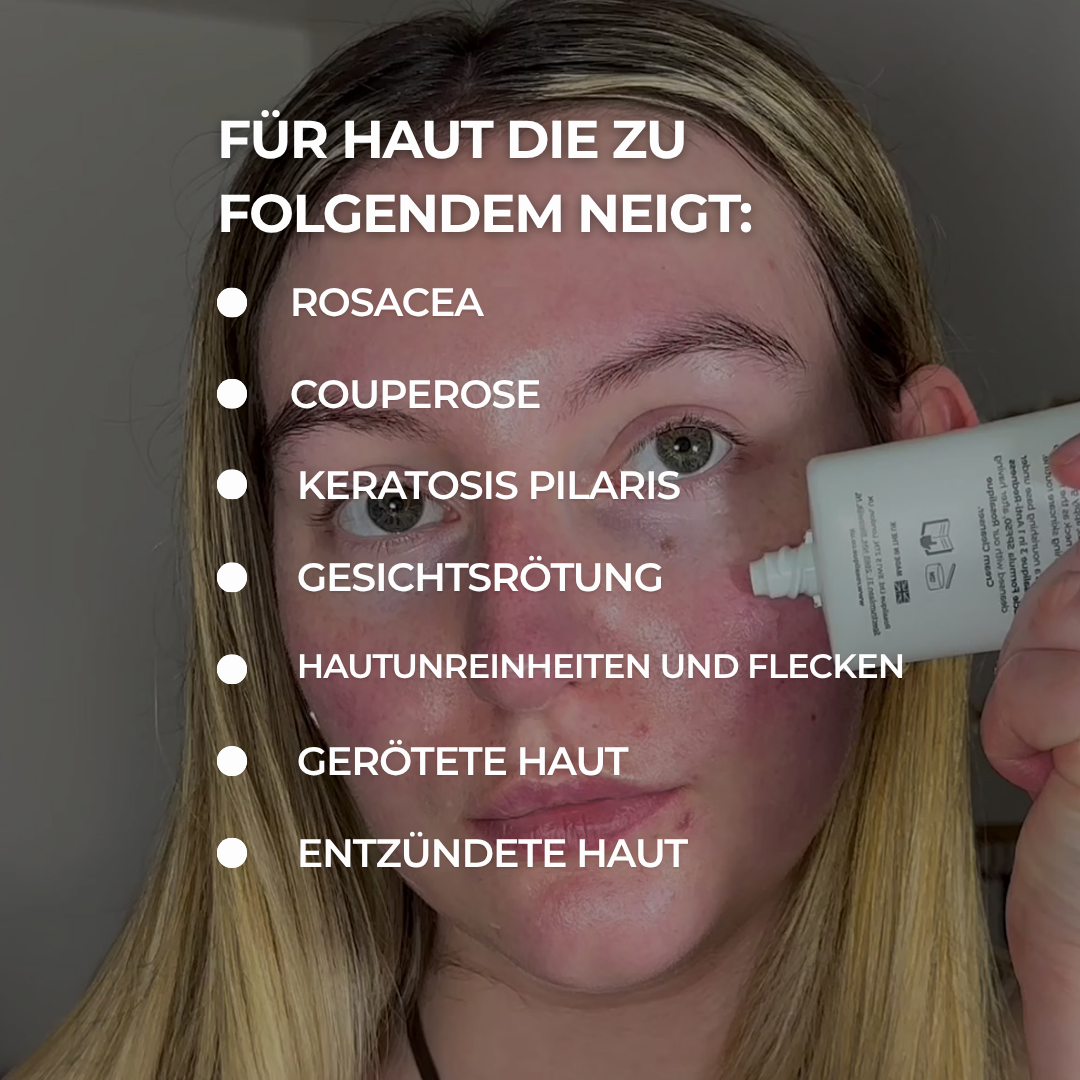 Rosalique Redness Relief Day Cream